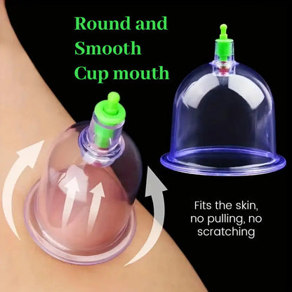 Vacuum Cupping Device
