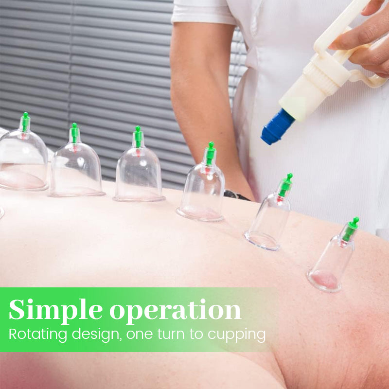 Vacuum Cupping Device