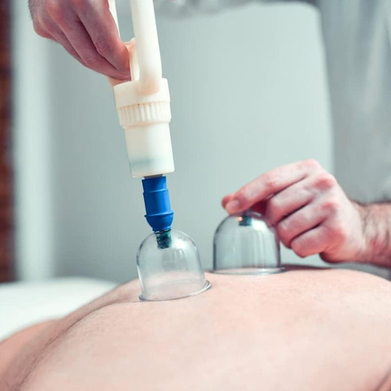 Vacuum Cupping Device