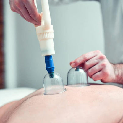 Vacuum Cupping Device