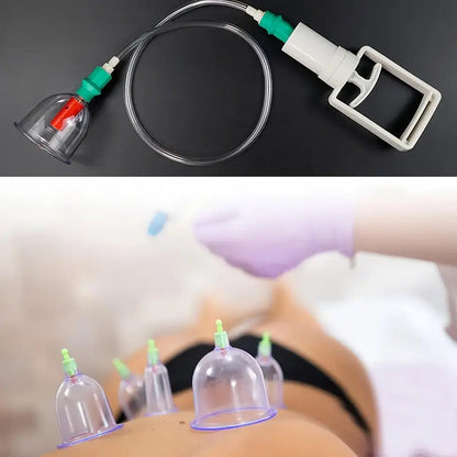 Vacuum Cupping Device